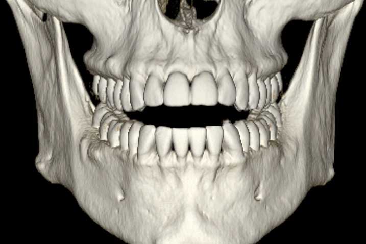 Denta Scan